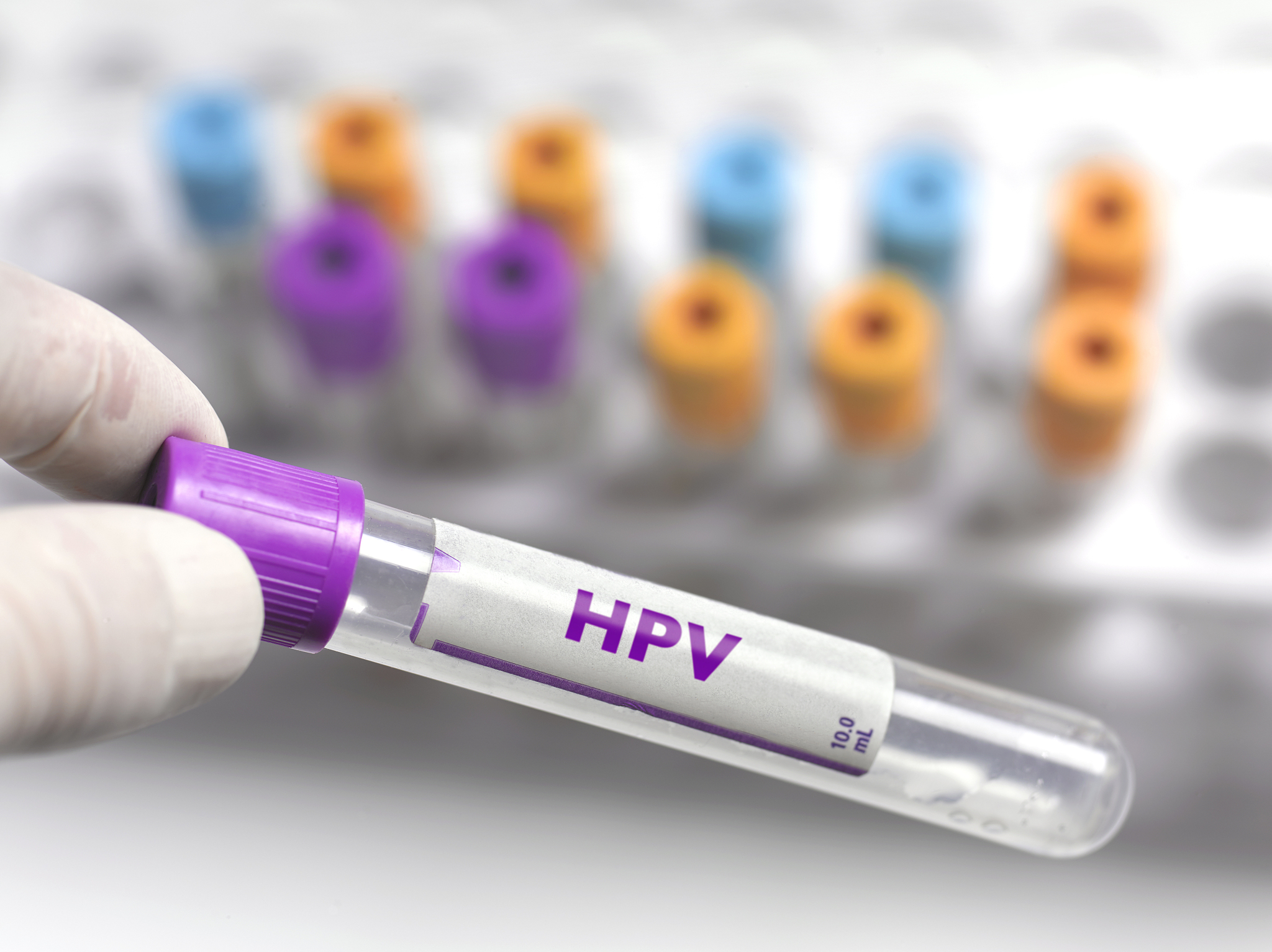 一图读懂丨有关HPV疫苗的科普问答
