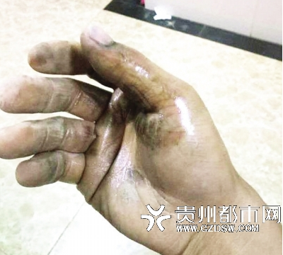 烟花爆炸致男子受伤 协商后商家赔偿1000元